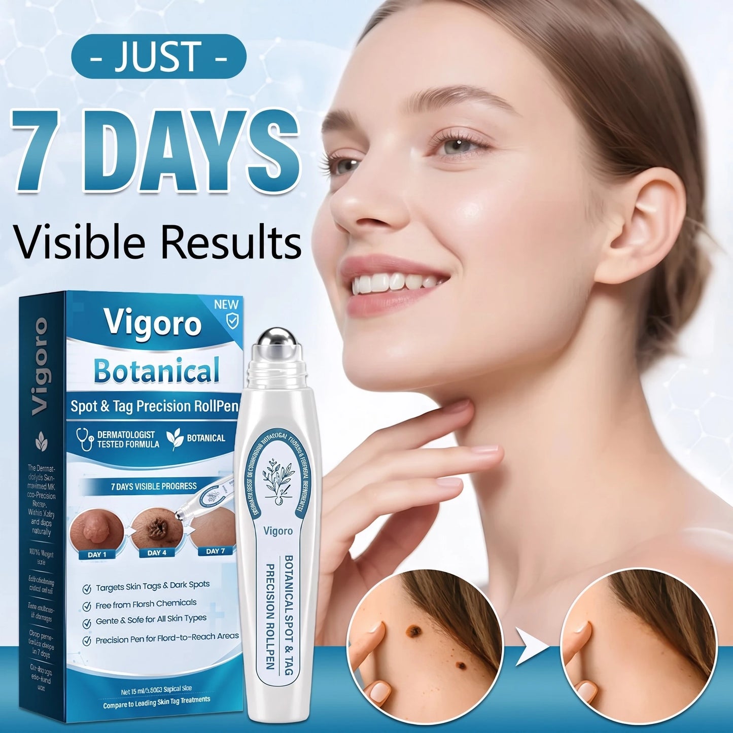 Vigoro™ Botanical Spot - Tag Precision RollPen