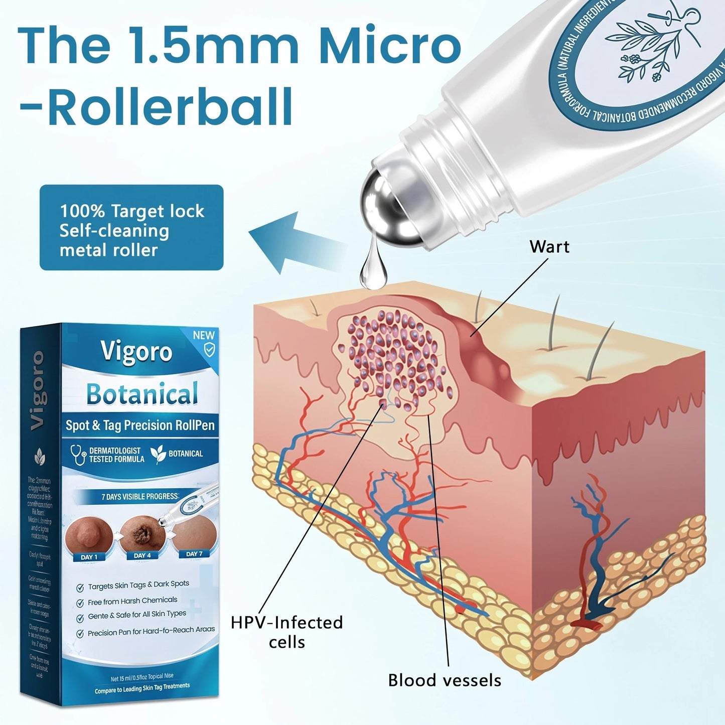Vigoro™ Botanical Spot - Tag Precision RollPen