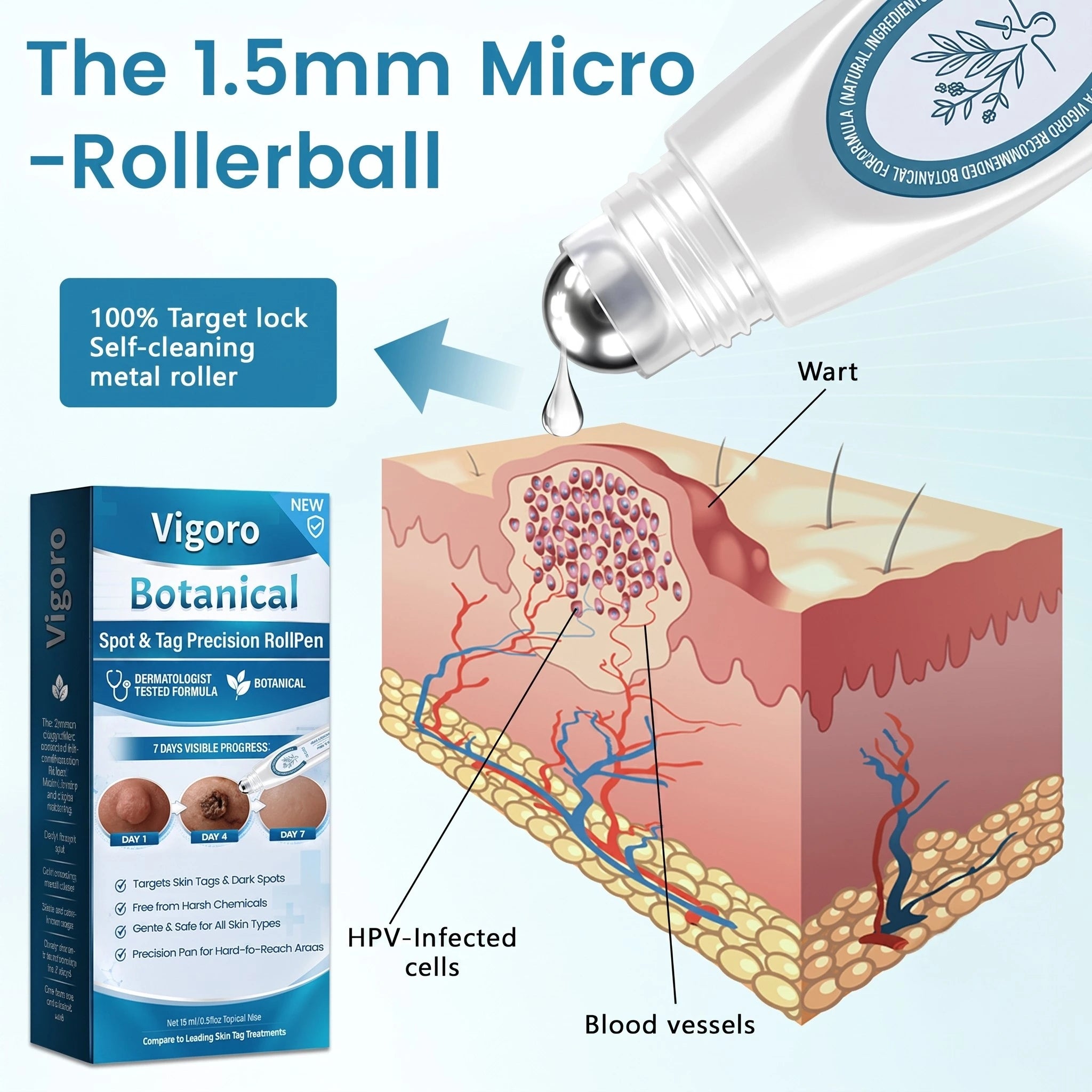 Vigoro® Botanical Spot & Tag Precision RollPen